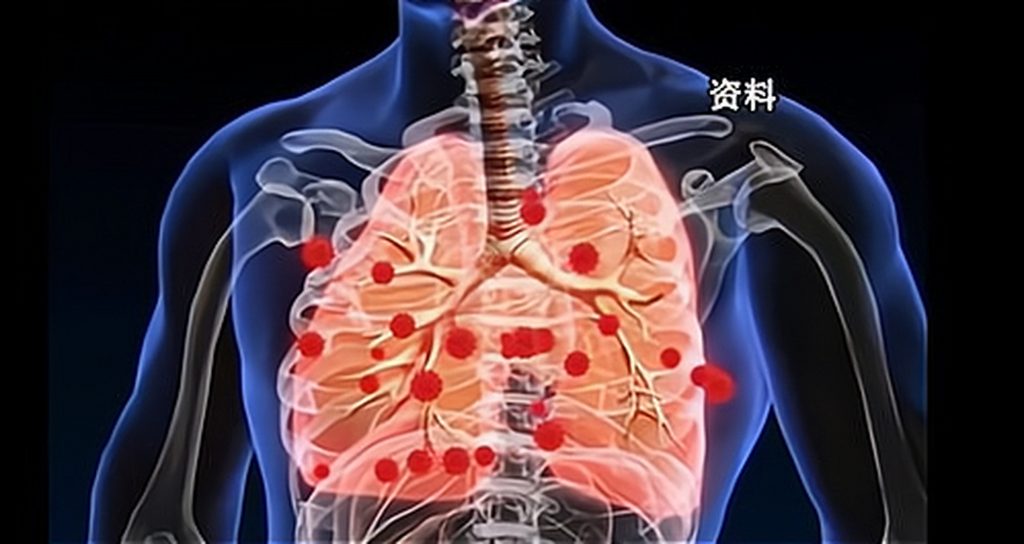 图片[1]-专家科普人偏肺病毒 冬春这样守护呼吸道健康-梧桐树下